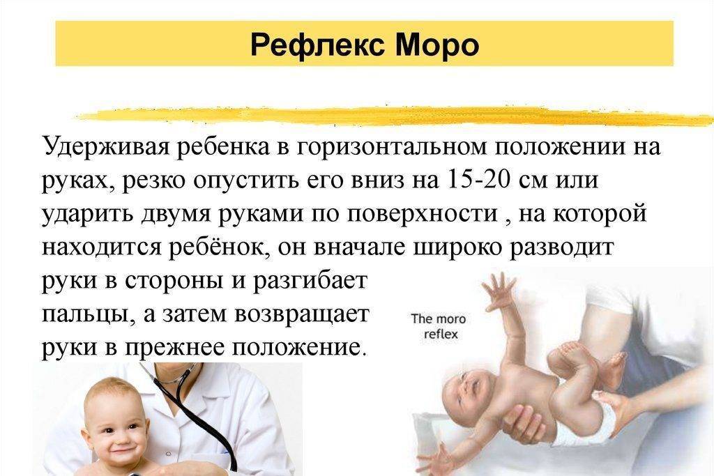 Рефлекс моро — особенности проверки реакции испуга у новорожденных — med-anketa.ru