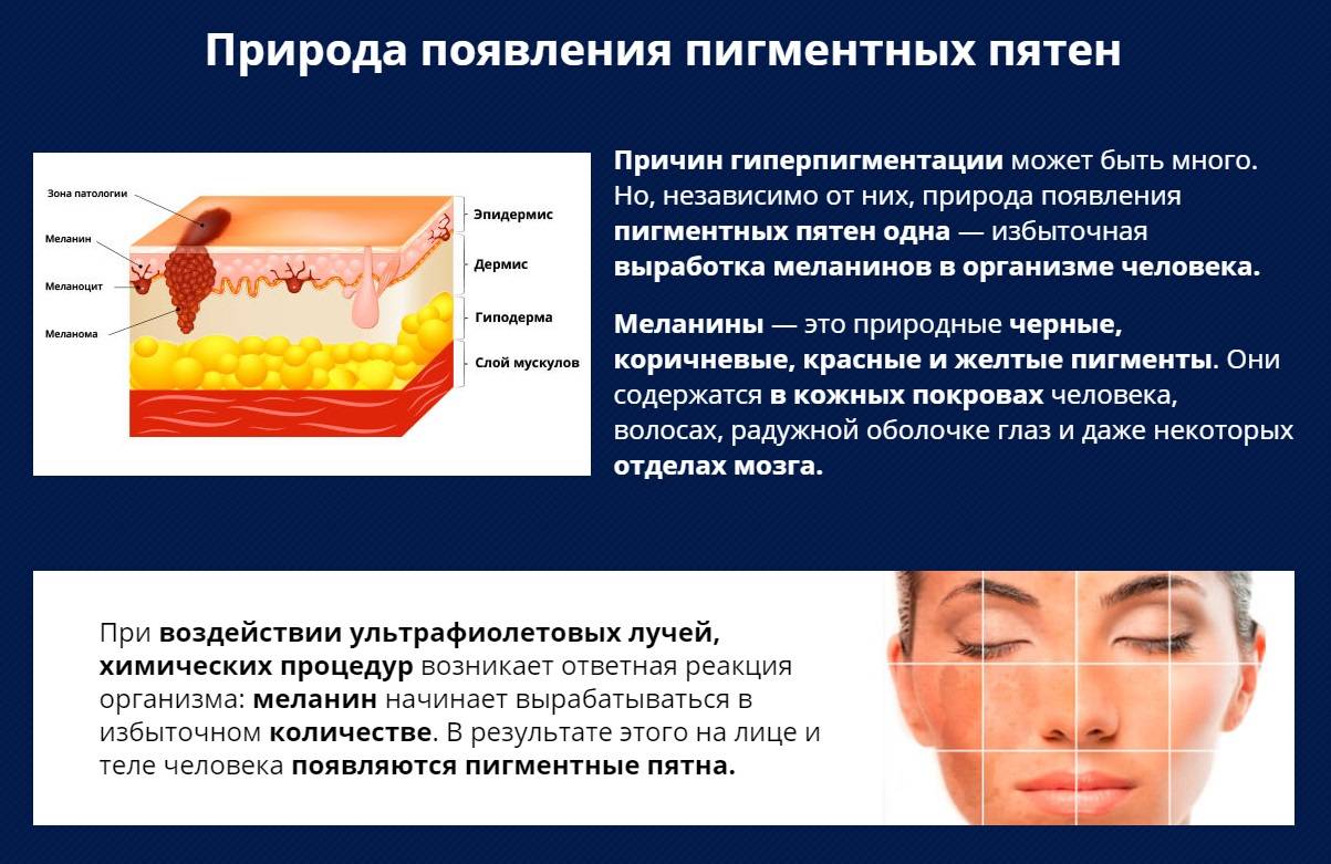 Пигментация после беременности и родов: как вернуть и сохранить ровный цвет лица - мамэксперт