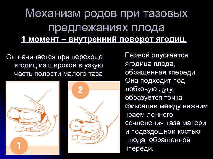 Кесарево сечение или нет? особенности ведения беременности и родов при тазовом предлежании плода