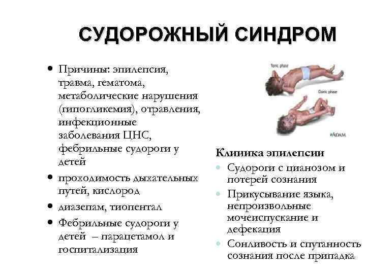 Судороги у грудничка: как проявляются, симптомы и причины