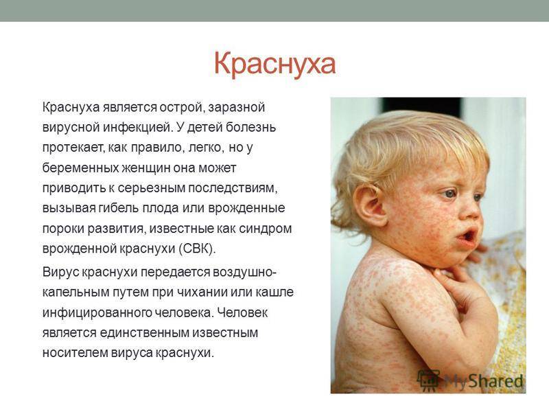 Корь: симптомы у детей до года, как выглядит, лечение и осложнения сыпи