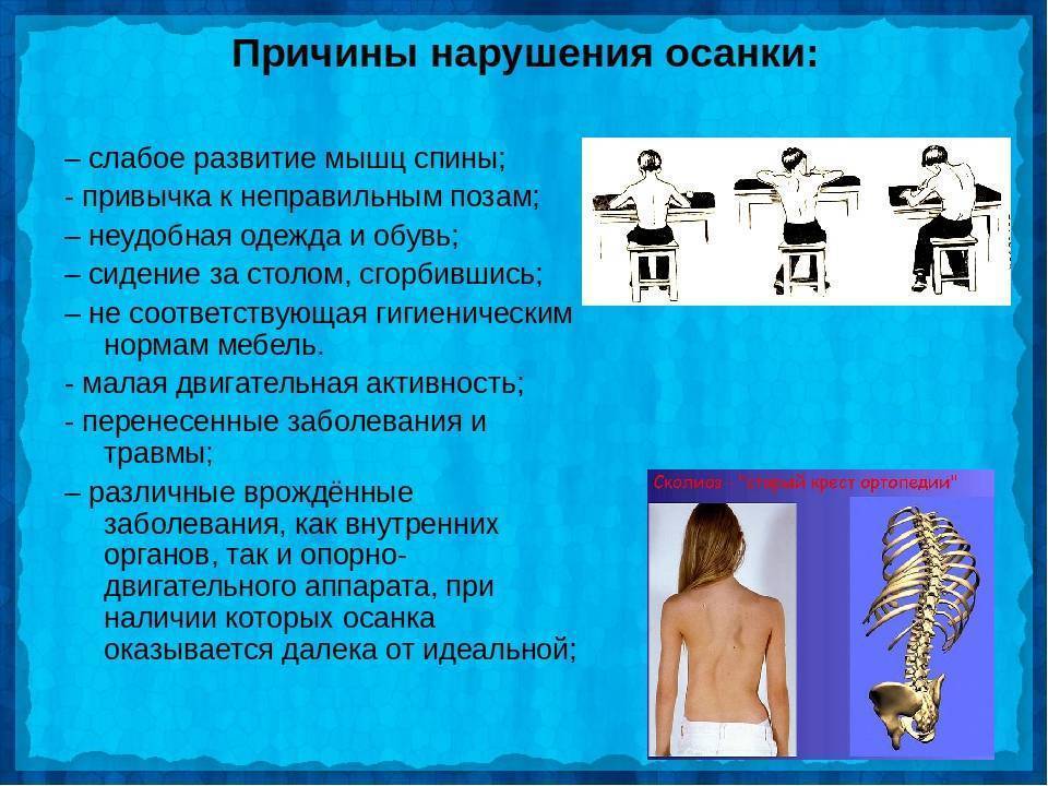 Такой разный сколиоз