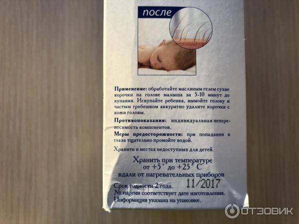Как убрать корочки на голове у ребенка?