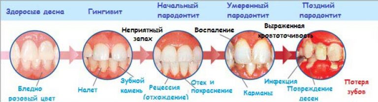 Как лечить стоматит у детей | блог мед. центра альтернатива