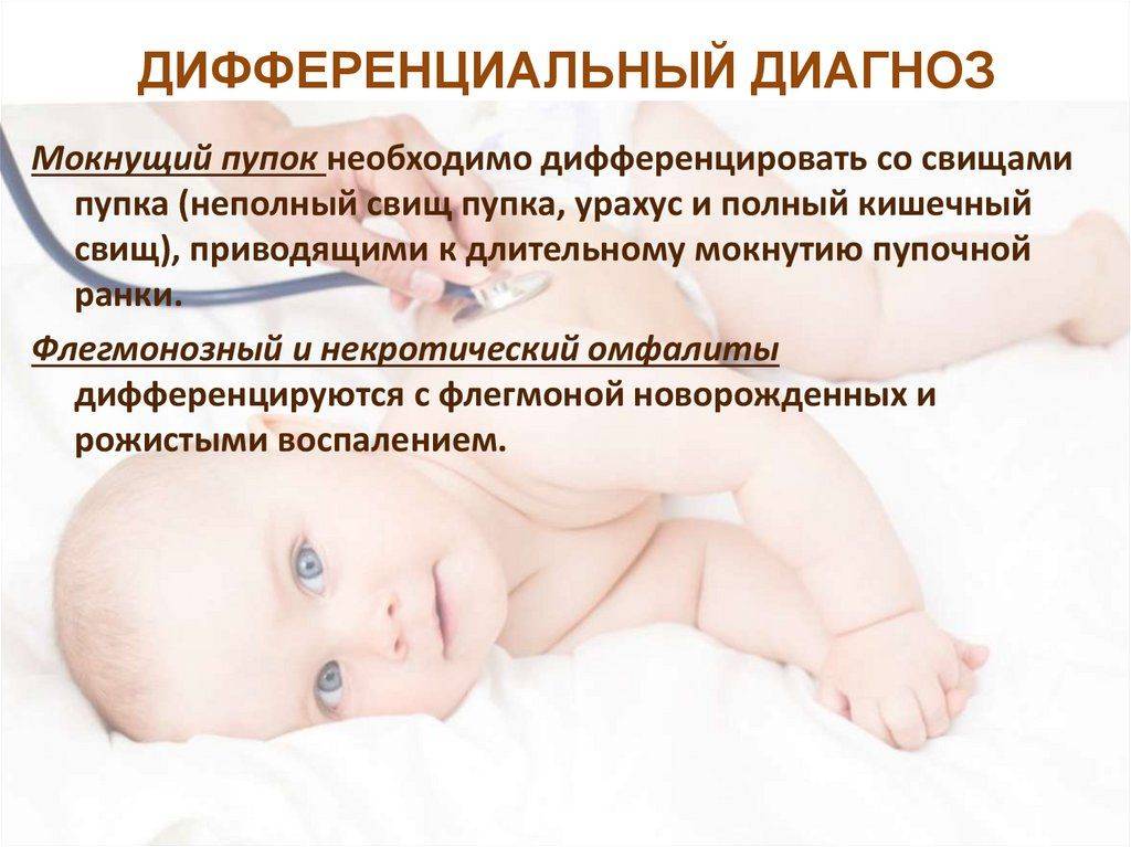 Мокнущий пупок у новорожденных — симптомы и лечение омфалита у новорожденных