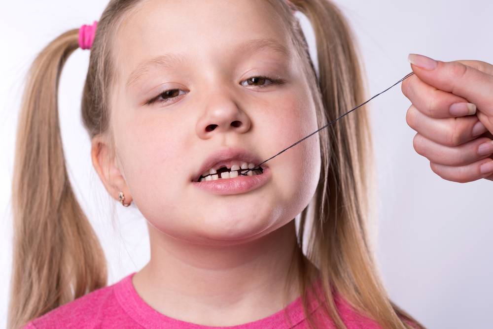 Молочные зубки стали подвижными - dentconsult.ru
