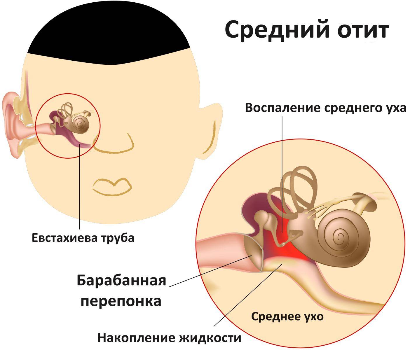 Как определить что у ребенка болят уши - диагностика, лечение