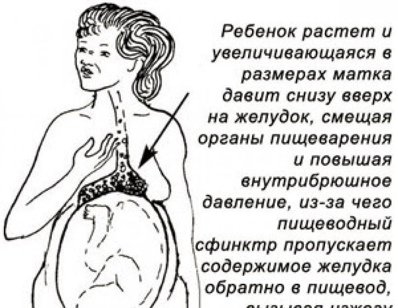 Как бороться с изжогой при беременности?   | материнство - беременность, роды, питание, воспитание