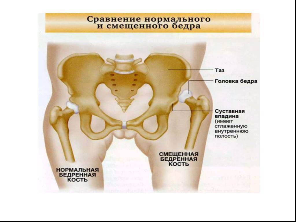 Лобковые кости после родов