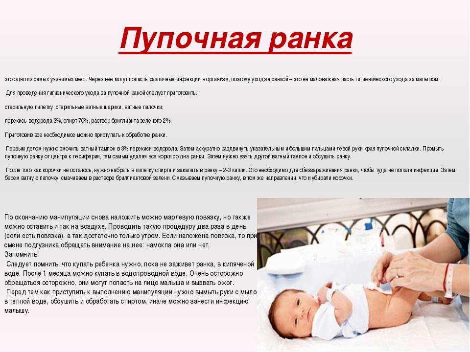 Как обрабатывать пупок новорожденного