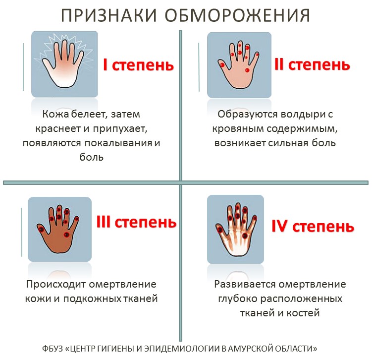 Первая помощь при обморожении: что делать при переохлаждении и отморожении? | окейдок