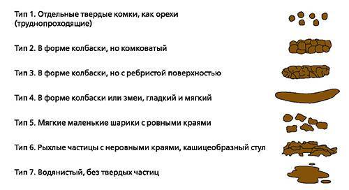 Запор у новорожденного при искусственном вскармливании