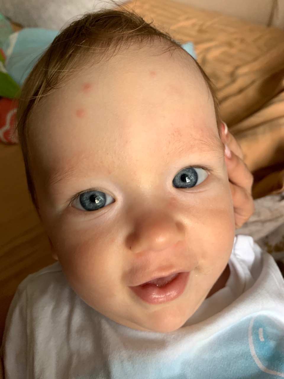 Прыщики на лице у новорожденного в 1 месяц: мелкие, красные на голове, щечках и лбу, а также белые и гнойнички | moninomama.ru