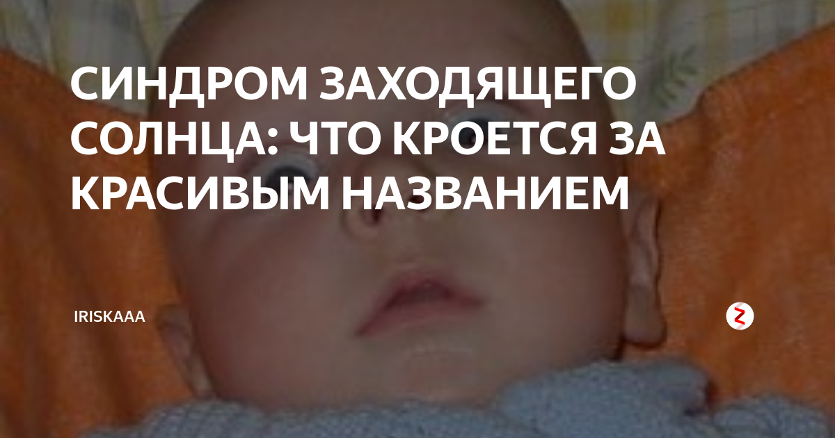 Причины, симптомы и лечение симптома грефе