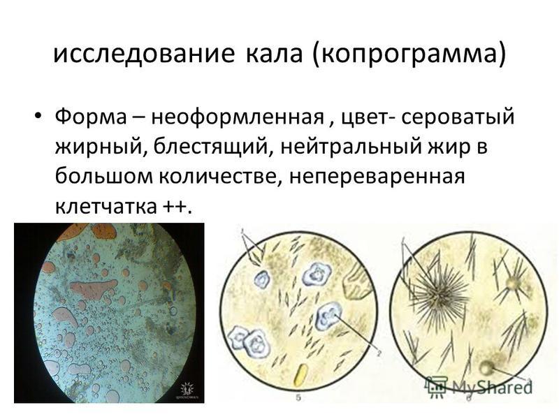 Расшифровка копрограммы кала у грудничка
