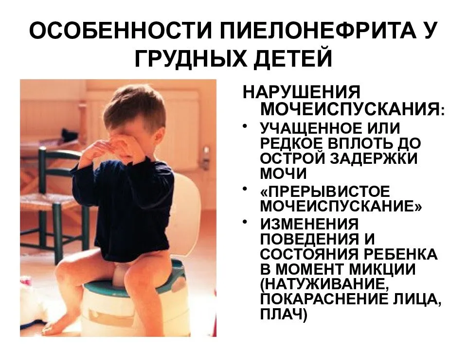 Пиелонефрит у грудничка: причины, симптомы и лечение