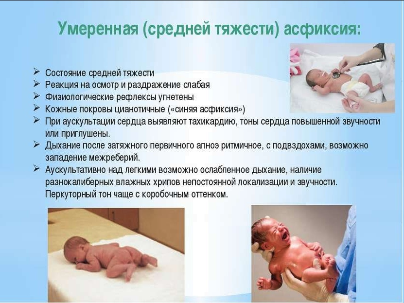 Асфиксия новорожденных: 5 механизмов развития, 3 степени тяжести
