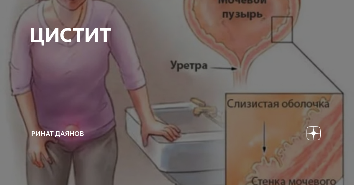 Боль при мочеиспускании у ребенка: лечение, причины