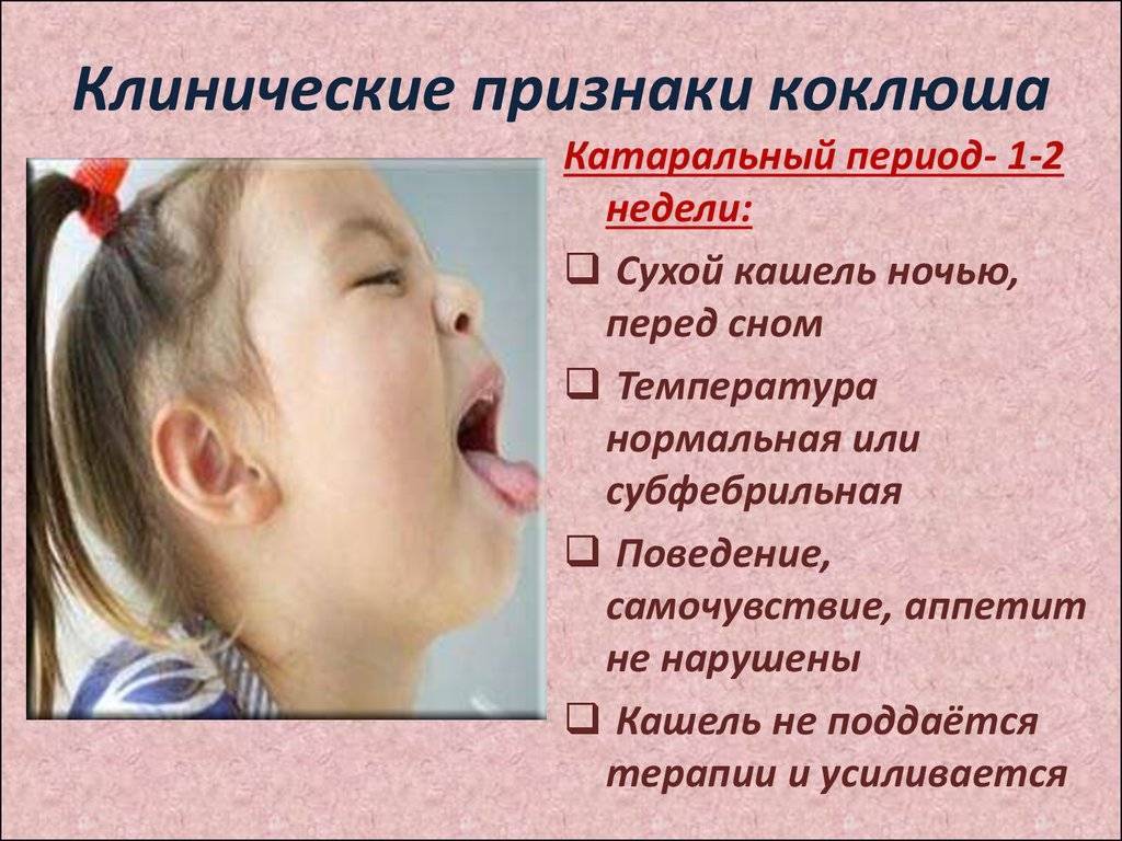 Комаровский коклюш у детей: признкаки, симптомы и лечение | prof-medstail.ru