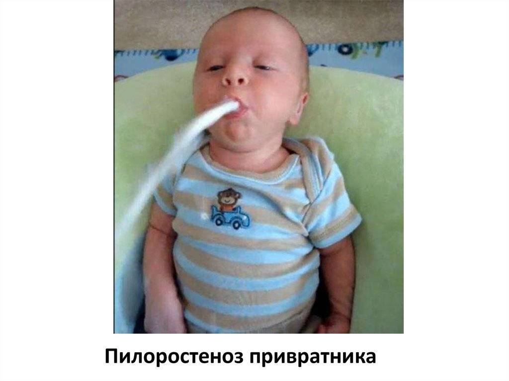 Ребёнок срыгивает фонтаном после кормления (обильные срыгивания)