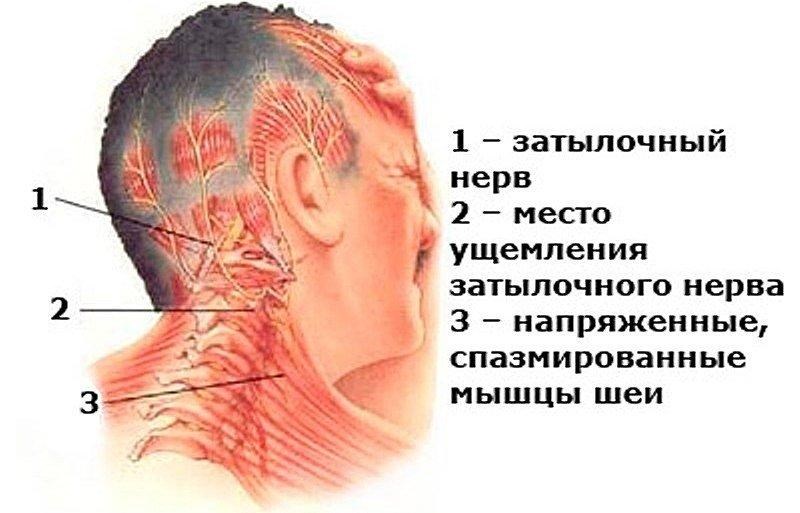 Почему у ребенка шея болит сзади или с одной стороны – с правой или левой, он не может поворачивать голову, что делать?