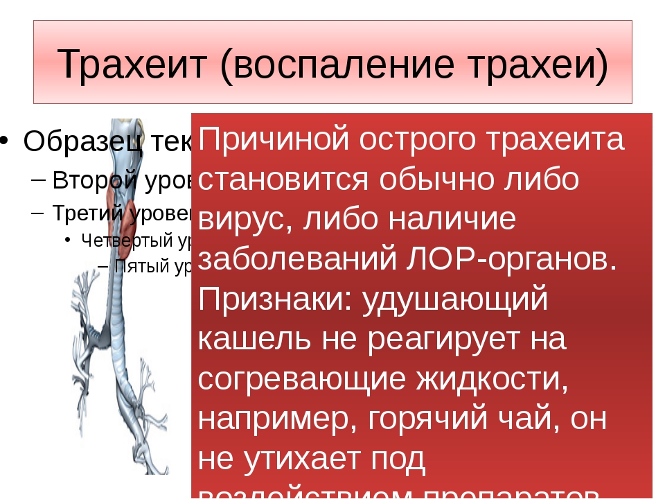 Каковы симптомы, и чем лечить ларинготрахеит у детей
