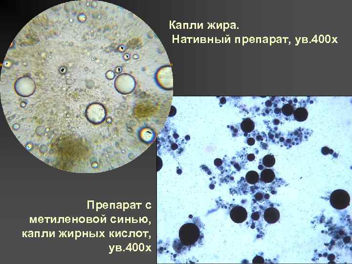 Копрограмма кала, расшифровка у грудничка