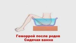 Что нельзя делать после родов: 10 важных запретов - блог о детях
