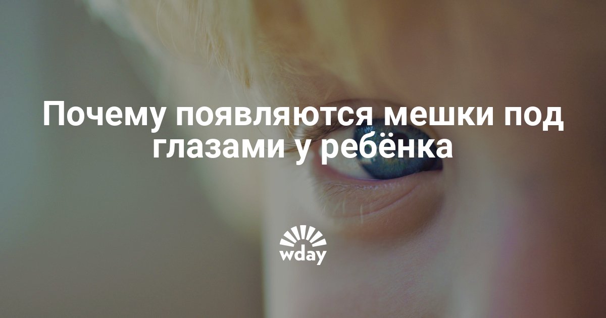Мешки под глазами у грудничка - причины, последствия, лечение