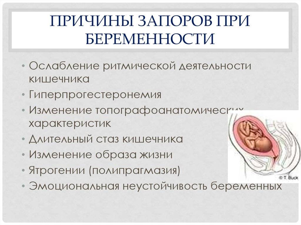 Запоры при беременности: причины, лечение, осложнения