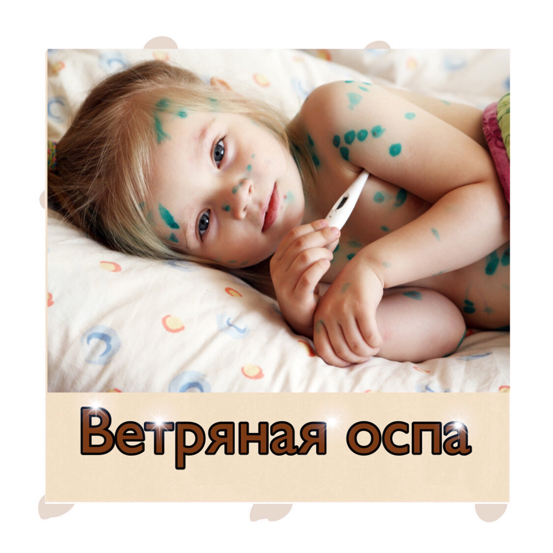 Можно ли купаться ветряной оспе. важная и исчерпывающая информация о купании при ветряке. вред или польза