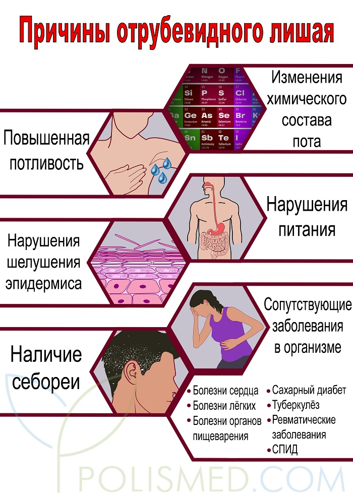 Отрубевидный (разноцветный) лишай: ление, препараты, мази