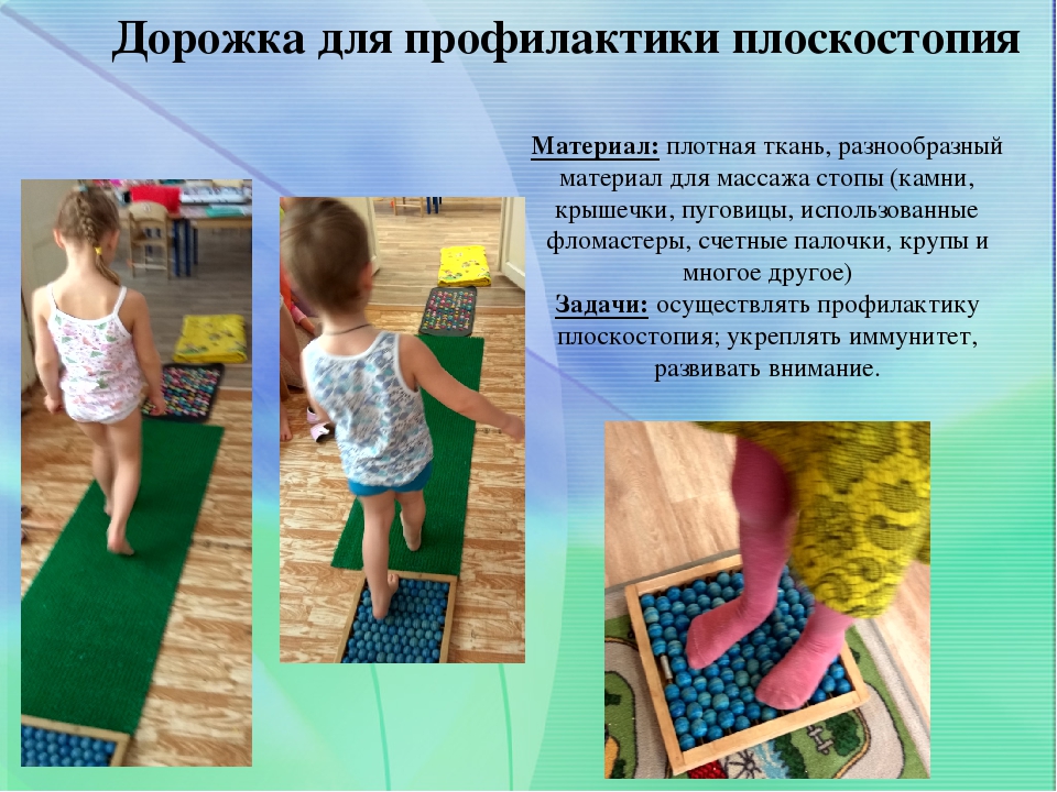 Профилактика плоскостопия у детей дошкольного возраста