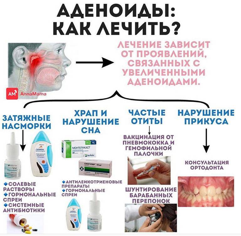 Гипертрофия аденоидов у детей - степени и лечение