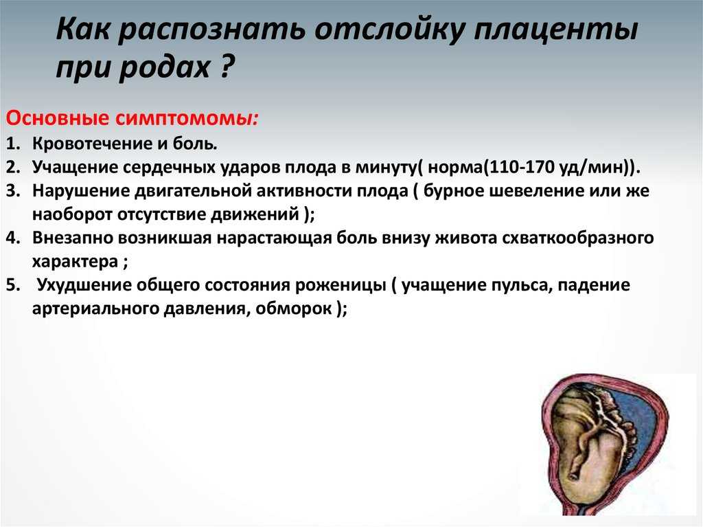 Отслойка плаценты карта вызова