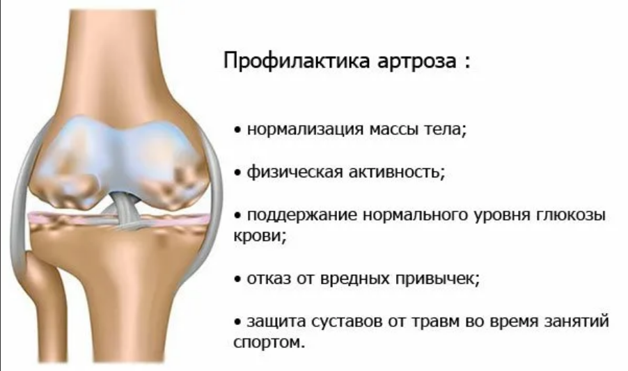 Почему сустав. Артрит коленного сустава карта вызова. Памятка остеоартроз коленного сустава. Деформирующий остеоартроз профилактика. Профилактика артрита коленного сустава.