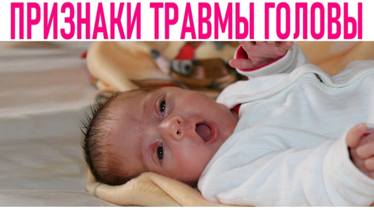 Ребенок упал с кровати: как понять, что с ним все хорошо?