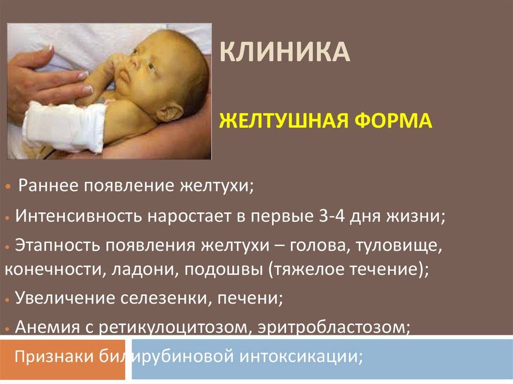 Желтуха у новорожденных. физиологическая, патологическая. причины и лечение желтухи | все о печени.ру