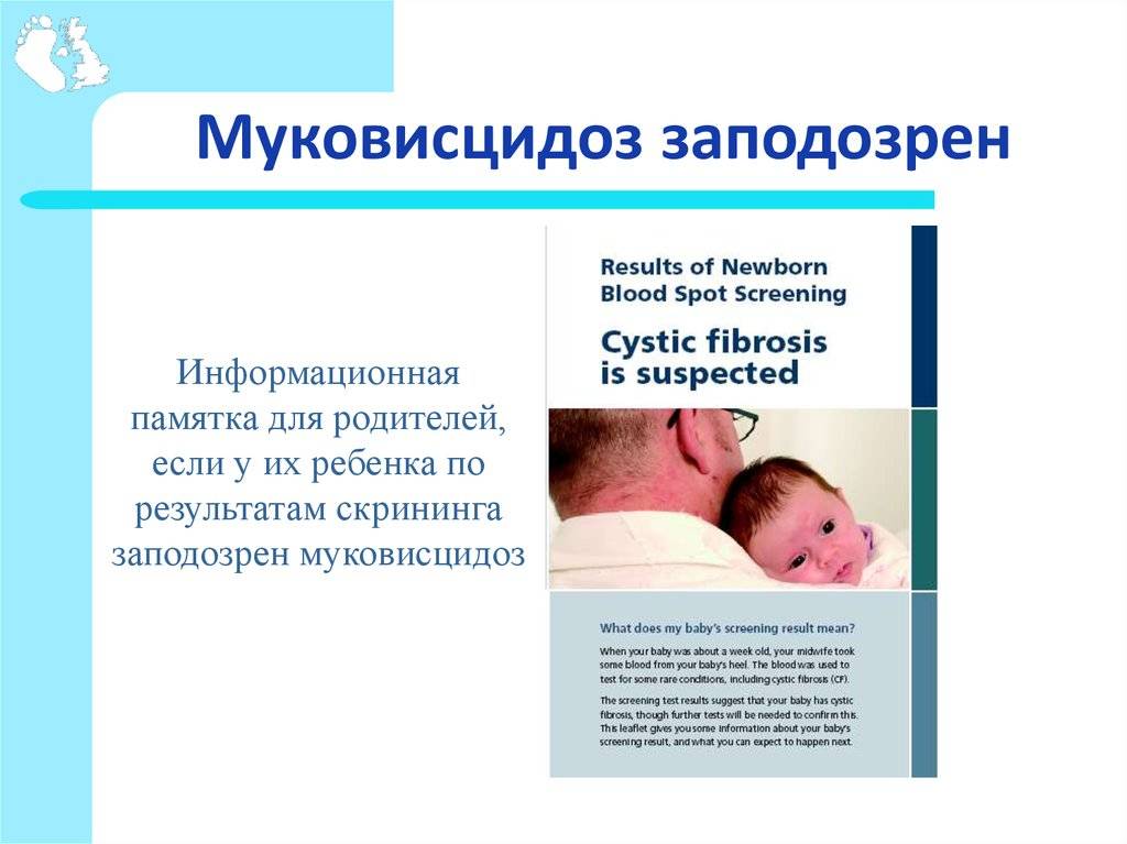 Муковисцидоз
