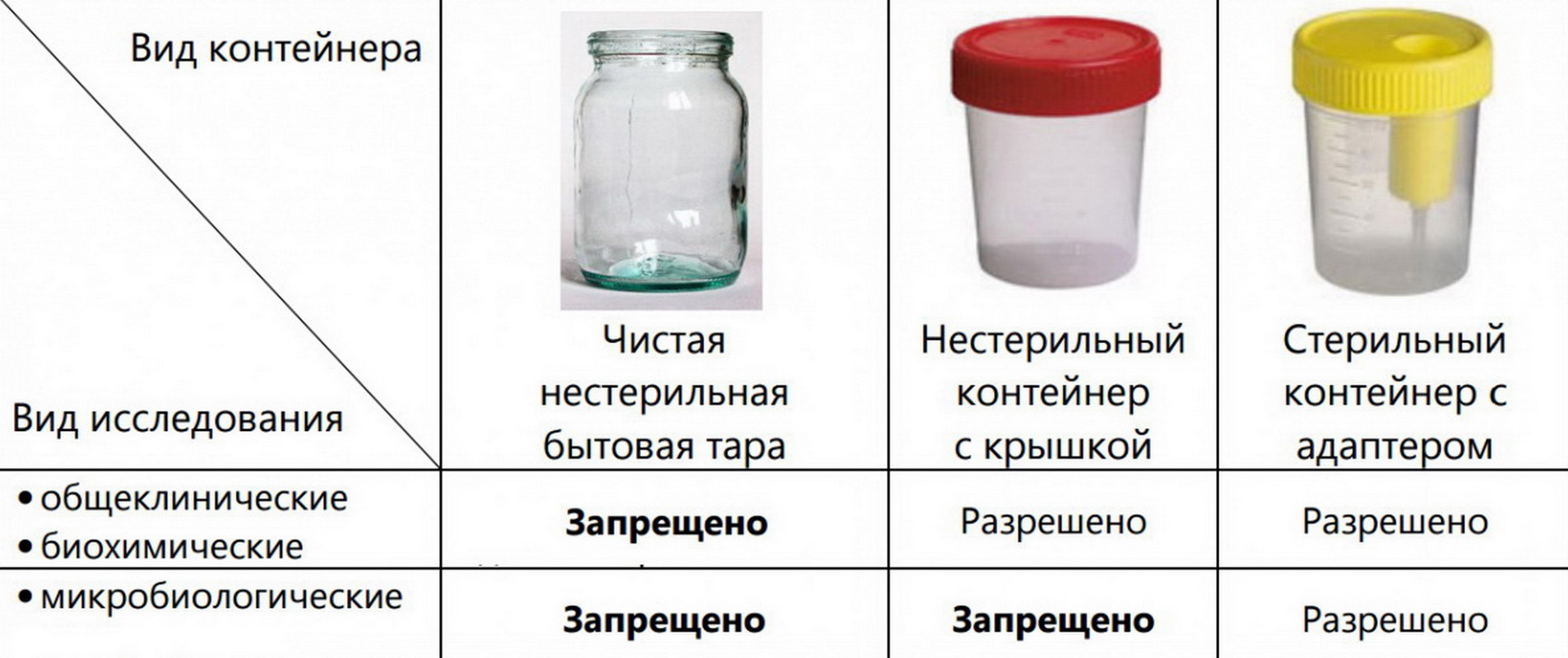 Анализ мочи — диагностика с максимальной результативностью * клиника диана в санкт-петербурге