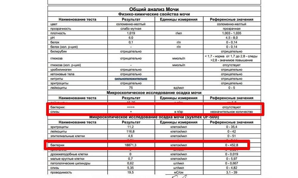4 основных причины повышения уровня лейкоцитов в моче у ребёнка