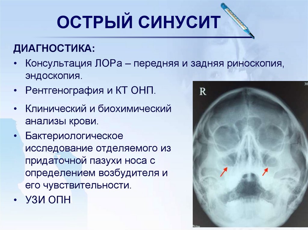 7 основных симптомов, которые говорят о гайморите у ребенка