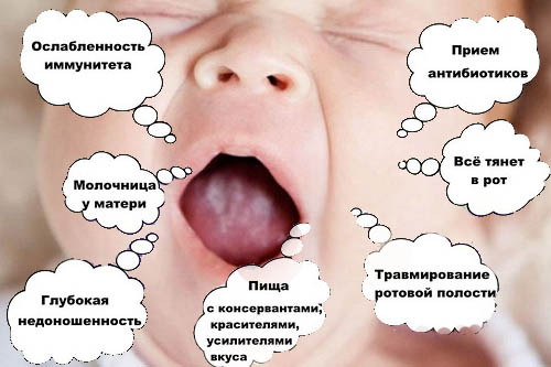 Причины образования белого налета на языке у грудничка и способы лечения