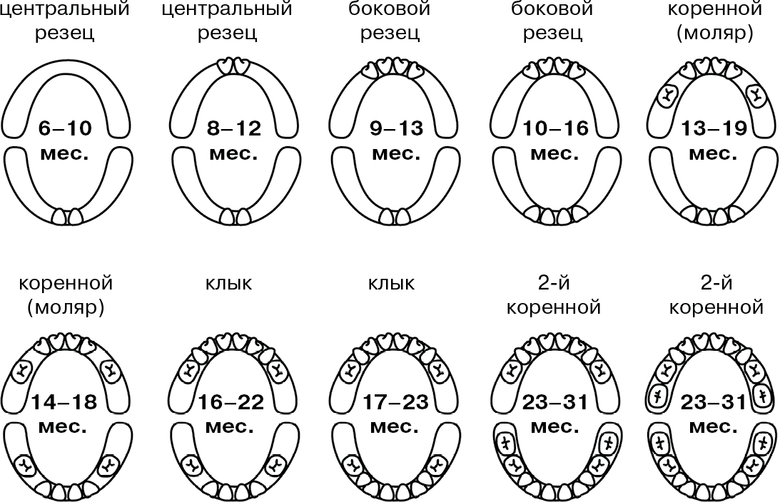 Как успокоить малыша, у которого режутся зубки