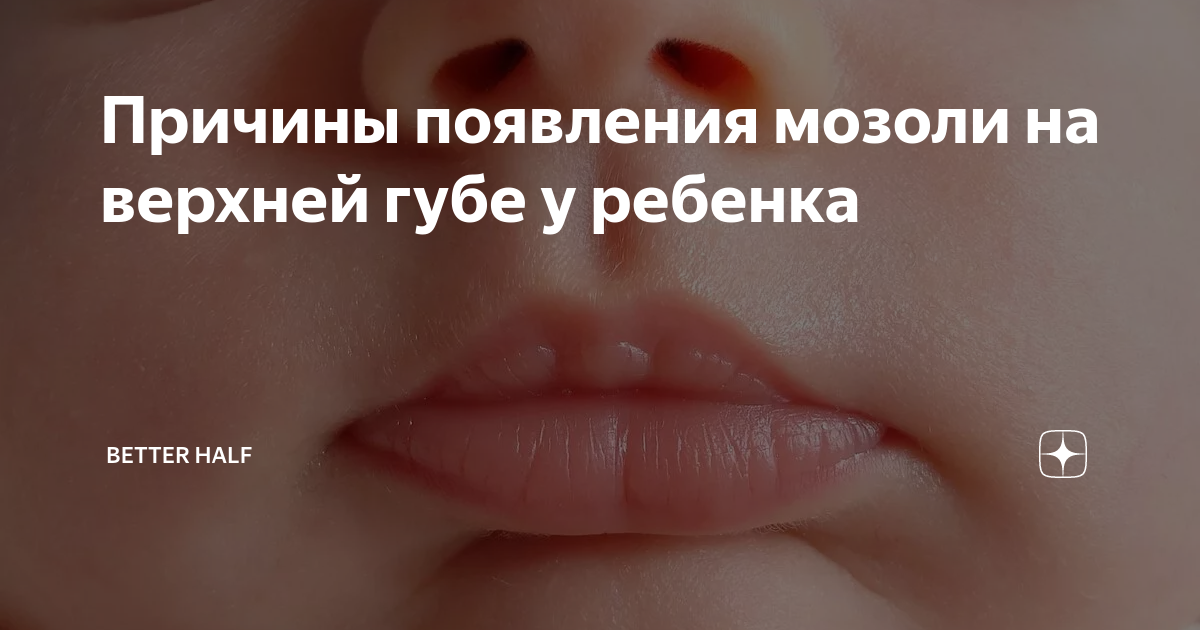 Мозоль на губе у новорожденного