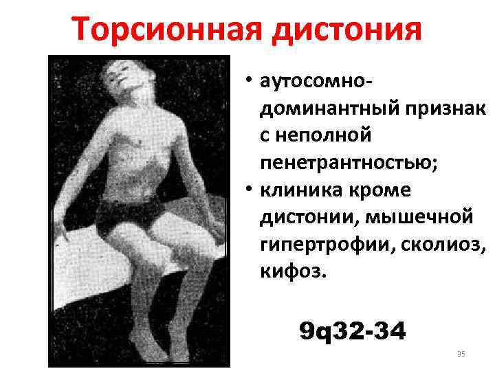 Синдром двигательных нарушений у грудничка, новорожденных, детей до года