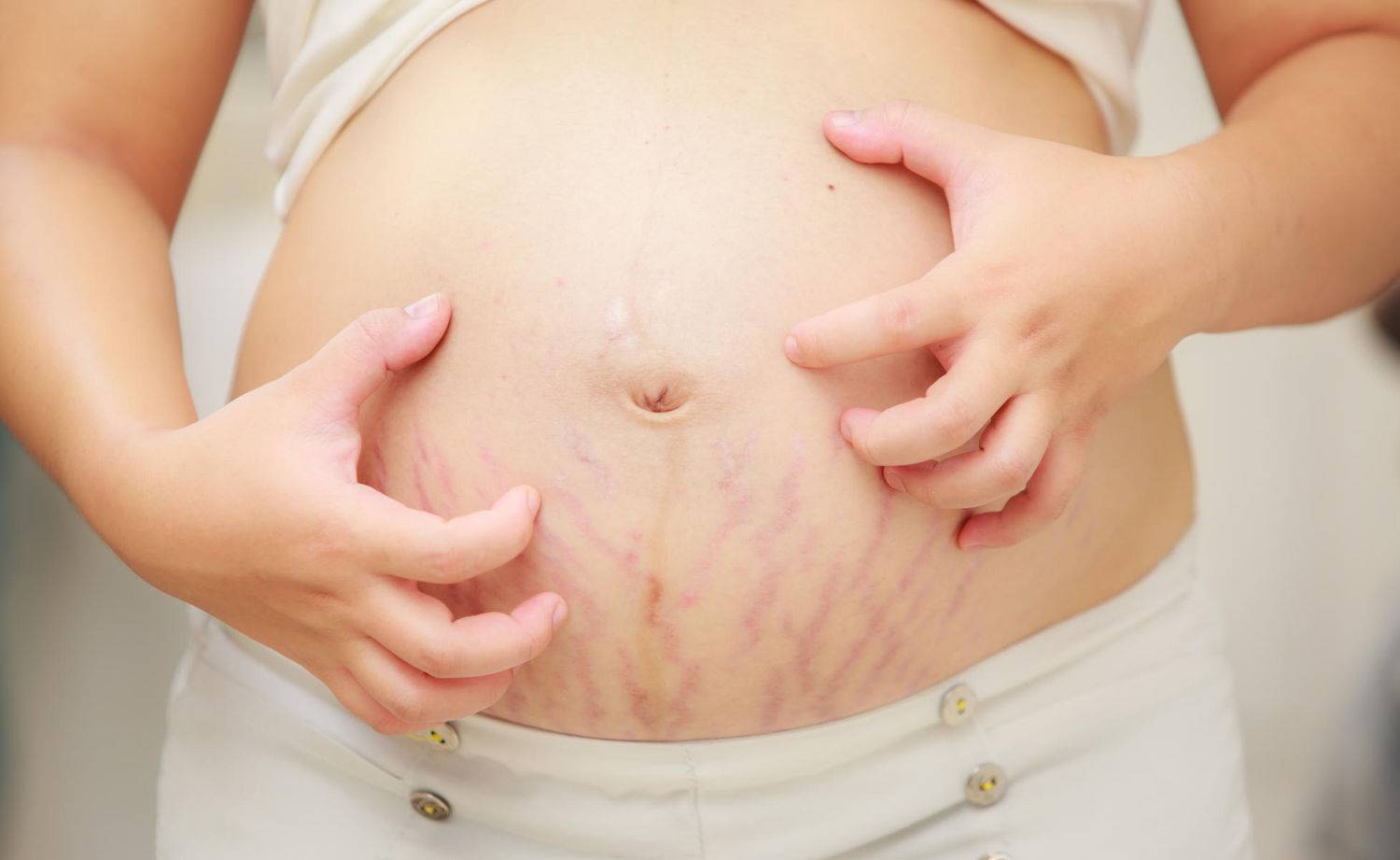 аллергия на груди у беременной фото 31