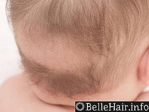 Залысина на затылке у грудничка - причины появления | ru-babyhealth