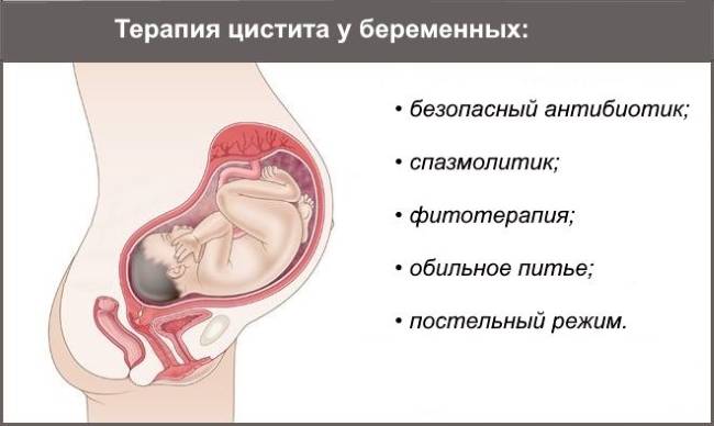 Цистит при беременности: на ранних и поздних сроках, причины, симптомы и лечение, профилактика, канефрон, отзывы, чем опасен