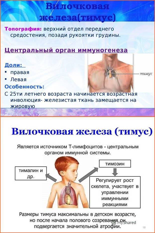 Гиперплазия вилочковой железы. Вилочковая железа у детей. Вилочковая железа (тимус). У детей.